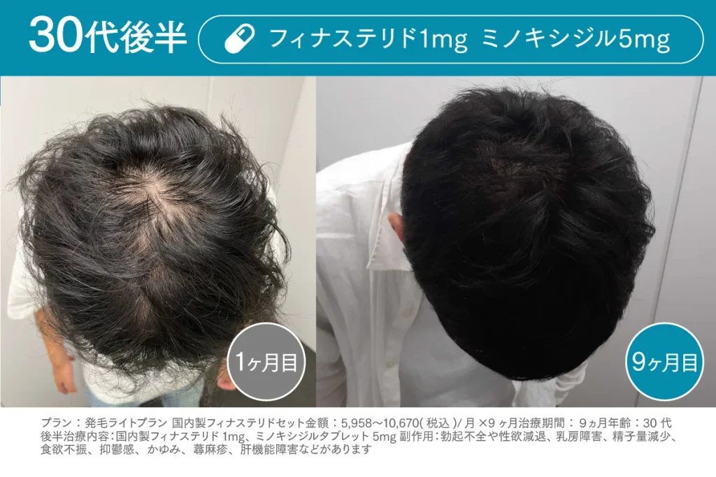 Before /After